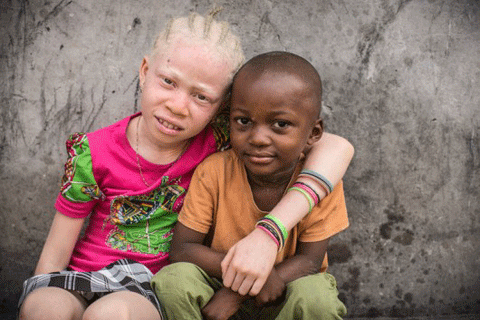 enfant-albinos